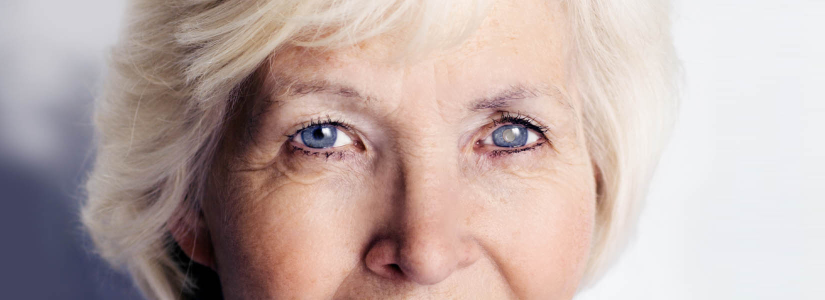Cataract Surgery in Vestal